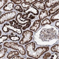 STK22C Antibody, Novus Biologicals 25 &mu;L, Unconjugated:Antibodies, Polyclonal