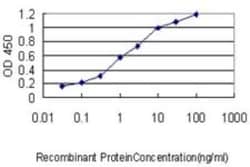 STK25 Antibody (1G6), Novus Biologicals 0.1 mg | Buy Online | Novus Biologicals | Fisher Scientific