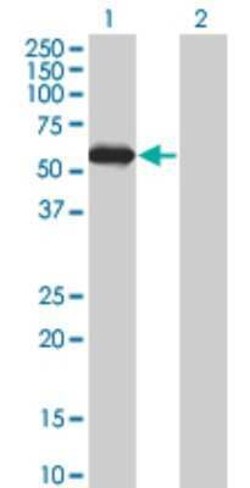 STK25 Antibody (1G6), Novus Biologicals 0.1 mg | Buy Online | Novus Biologicals | Fisher Scientific
