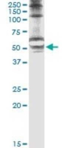 STK25 Antibody (4B10), Novus Biologicals 0.1 mg | Buy Online | Novus Biologicals | Fisher Scientific