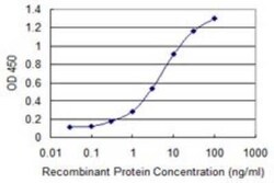 STK31 Antibody (1C10), Novus Biologicals 0.1 mg | Buy Online | Novus Biologicals | Fisher Scientific