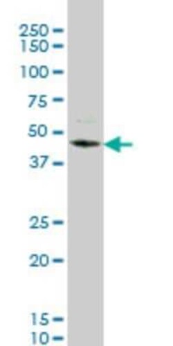 STK32C Antibody (4D12), Novus Biologicals 0.1 mg; Unconjugated:Antibodies,