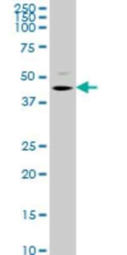 STK32C Antibody (4G2), Novus Biologicals 0.1 mg; Unconjugated:Antibodies,