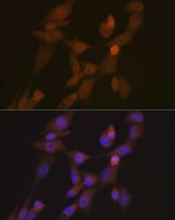 STK33 Rabbit anti-Human, Mouse, Clone: 1E4W7, Novus Biologicals 100 &mu;g | Buy Online | Novus Biologicals | Fisher Scientific