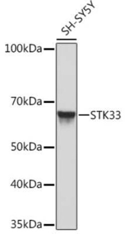 STK33 Rabbit anti-Human, Mouse, Clone: 1E4W7, Novus Biologicals 100 &mu;g | Buy Online | Novus Biologicals | Fisher Scientific