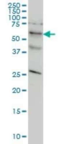 STK33 Antibody (6G1), Novus Biologicals 0.1 mg; Unconjugated:Antibodies,