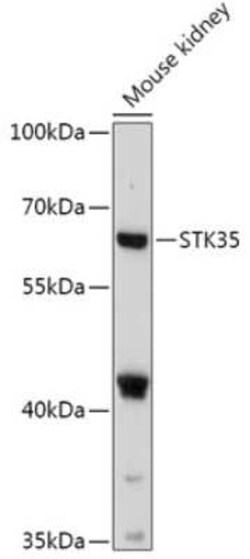 STK35 Antibody - Azide and BSA Free, Novus Biologicals:Antibodies:Primary