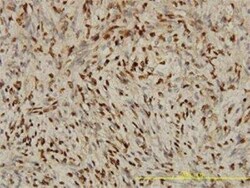 STK38 Antibody (2G8-1F3), Novus Biologicals 0.05 mg | Buy Online | Novus Biologicals | Fisher Scientific