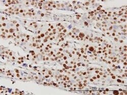STK38 Antibody (2G8-1F3), Novus Biologicals 0.05 mg | Buy Online | Novus Biologicals | Fisher Scientific