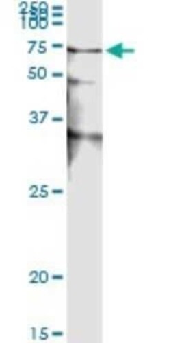 STK38 Antibody (2G8-1F3), Novus Biologicals 0.05 mg | Buy Online | Novus Biologicals | Fisher Scientific