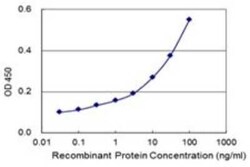 STK38 Antibody (2G8-1F3), Novus Biologicals 0.05 mg | Buy Online | Novus Biologicals | Fisher Scientific