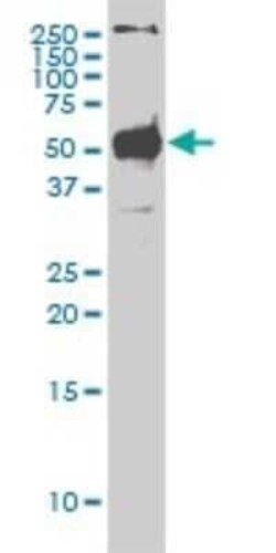 STK38 Antibody (2G8-1F3), Novus Biologicals 0.05 mg | Buy Online | Novus Biologicals | Fisher Scientific