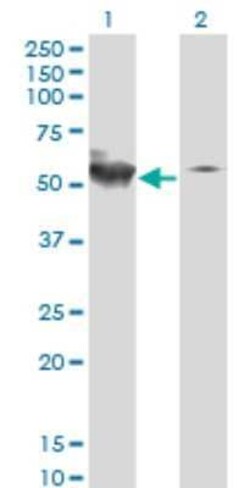STK38 Antibody (2G8-1F3), Novus Biologicals 0.05 mg | Buy Online | Novus Biologicals | Fisher Scientific