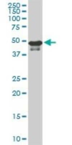 STK38 Antibody (3A5), Novus Biologicals 0.1 mg | Buy Online | Novus Biologicals | Fisher Scientific