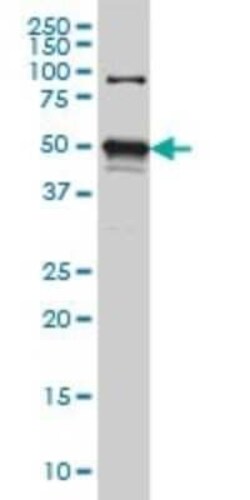 STK38 Antibody (3A5), Novus Biologicals 0.1 mg | Buy Online | Novus Biologicals | Fisher Scientific