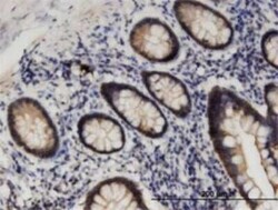 STK38L Antibody (4E5), Novus Biologicals 0.1 mg | Buy Online | Novus Biologicals | Fisher Scientific