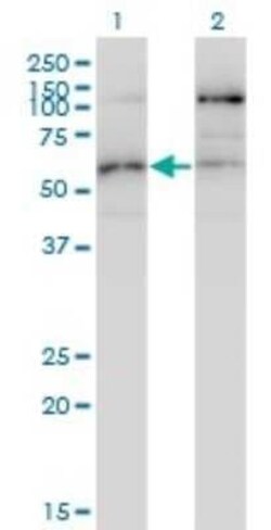 STK38L Antibody (4E5), Novus Biologicals 0.1 mg | Buy Online | Novus Biologicals | Fisher Scientific