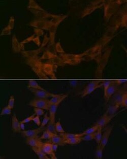 STK39 Rabbit anti-Human, Mouse, Rat, Clone: 0D9L5, Novus Biologicals 100 &mu;g | Buy Online | Novus Biologicals | Fisher Scientific