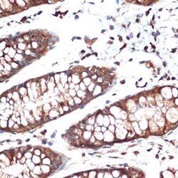 STK39 Rabbit anti-Human, Mouse, Rat, Clone: 0D9L5, Novus Biologicals 100 &mu;g | Buy Online | Novus Biologicals | Fisher Scientific