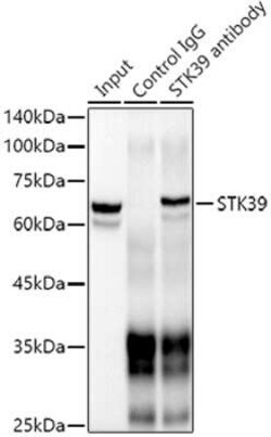 STK39 Rabbit anti-Human, Mouse, Rat, Clone: 0D9L5, Novus Biologicals 100 &mu;g | Buy Online | Novus Biologicals | Fisher Scientific
