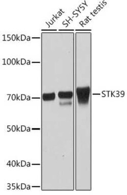 STK39 Rabbit anti-Human, Mouse, Rat, Clone: 0D9L5, Novus Biologicals 100 &mu;g | Buy Online | Novus Biologicals | Fisher Scientific