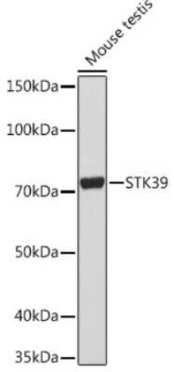 STK39 Rabbit anti-Human, Mouse, Rat, Clone: 0D9L5, Novus Biologicals 100 &mu;g | Buy Online | Novus Biologicals | Fisher Scientific