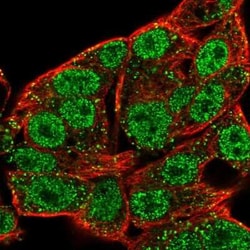 STK39 Antibody, Novus Biologicals:Antibodies:Primary Antibodies