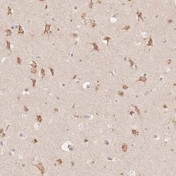 STK39 Antibody, Novus Biologicals:Antibodies:Primary Antibodies