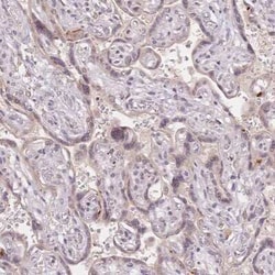 STK39 Antibody, Novus Biologicals:Antibodies:Primary Antibodies