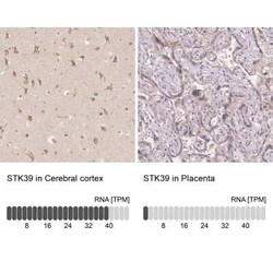 STK39 Antibody, Novus Biologicals:Antibodies:Primary Antibodies