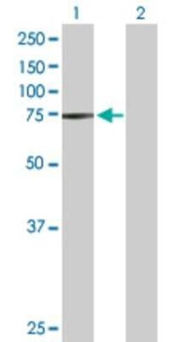 STRA6 Antibody, Novus Biologicals 0.1 mg | Buy Online | Novus Biologicals | Fisher Scientific