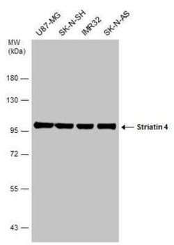 STRN4 Antibody, Novus Biologicals 100 &mu;g; Unconjugated:Antibodies, Polyclonal