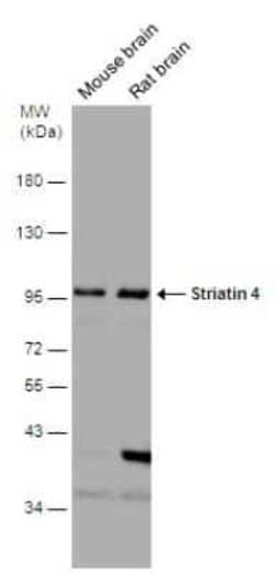 STRN4 Antibody, Novus Biologicals 100 &mu;g; Unconjugated:Antibodies, Polyclonal