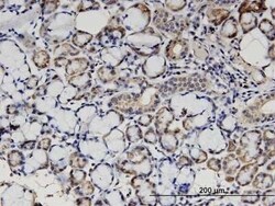 STX18 Antibody (2E5), Novus Biologicals 0.1 mg | Buy Online | Novus Biologicals | Fisher Scientific