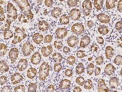 SUCLG1 Antibody, Novus Biologicals 50 &mu;g, Unconjugated:Antibodies, Polyclonal