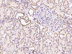 SUCLG1 Antibody, Novus Biologicals 50 &mu;g, Unconjugated:Antibodies, Polyclonal