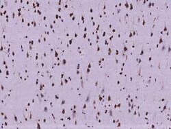 SUHW1 Antibody, Novus Biologicals 100 &mu;g, Unconjugated:Antibodies, Polyclonal