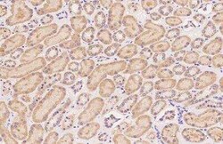 SUHW2 Antibody, Novus Biologicals 100 &mu;g; Unconjugated:Antibodies, Polyclonal