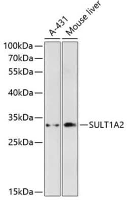 SULT1A2 Antibody - Azide and BSA Free, Novus Biologicals 0.1 mL, Unconjugated:Antibodies,