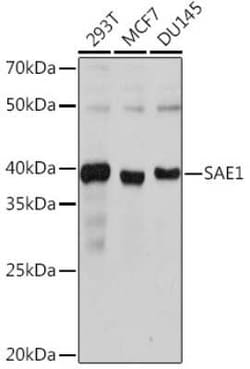 SUMO Activating Enzyme E1 (SAE1) Rabbit anti-Human, Mouse, Rat, Clone: