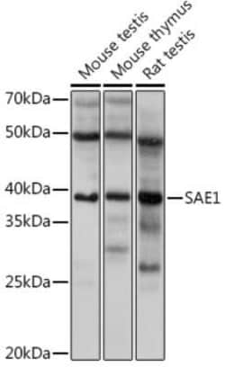 SUMO Activating Enzyme E1 (SAE1) Rabbit anti-Human, Mouse, Rat, Clone: