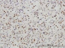 SUMO Activating Enzyme E1 (SAE1) Antibody (1G4-1G5), Novus Biologicals
