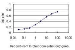 SUMO Activating Enzyme E1 (SAE1) Antibody (1G4-1G5), Novus Biologicals