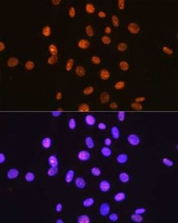 SUMO1 Rabbit anti-Human, Mouse, Rat, Clone: 6F8B6, Novus Biologicals 100 &mu;g | Buy Online | Bio-Techne | Fisher Scientific