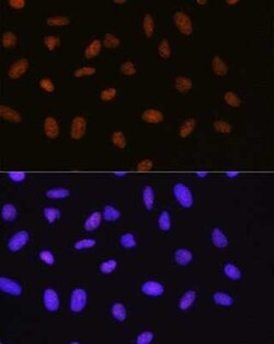 SUMO1 Rabbit anti-Human, Mouse, Rat, Clone: 6F8B6, Novus Biologicals 100 &mu;g | Buy Online | Bio-Techne | Fisher Scientific