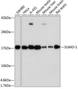 SUMO1 Rabbit anti-Human, Mouse, Rat, Clone: 6F8B6, Novus Biologicals 100 &mu;g | Buy Online | Bio-Techne | Fisher Scientific