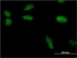 SUMO1 Antibody (3D7), Novus Biologicals 0.1 mg | Buy Online | Novus Biologicals | Fisher Scientific