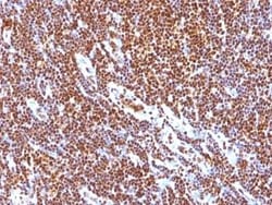 SUMO1 Antibody (SUMO1/1188), Novus Biologicals:Antibodies:Primary Antibodies