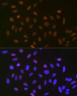 SUMO2/3 Rabbit anti-Human, Mouse, Rat, Clone: 6R8G7, Novus Biologicals:Antibodies:Primary