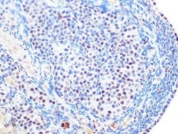 SUMO2/3 Rabbit anti-Human, Mouse, Rat, Clone: 6R8G7, Novus Biologicals:Antibodies:Primary